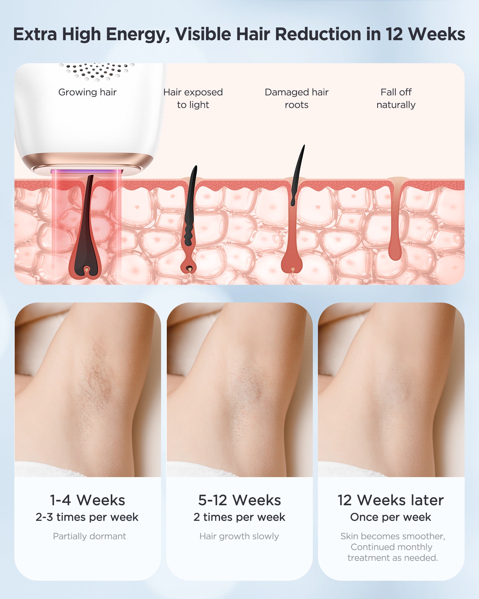 IPL Hair Removal Device